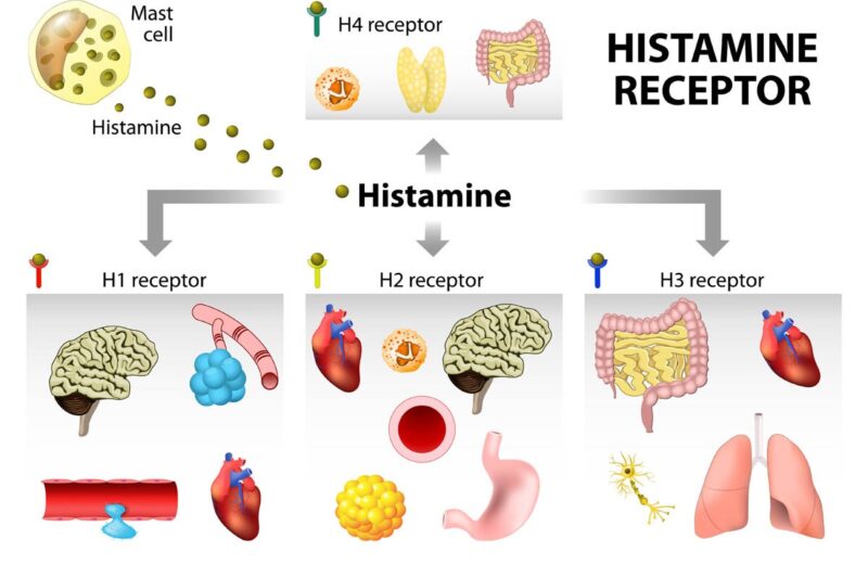 Histamin İntoleransı